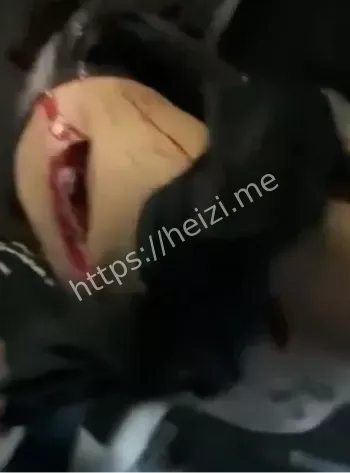劝架误伤